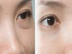 眼袋的搞笑说说 关于眼袋的说说