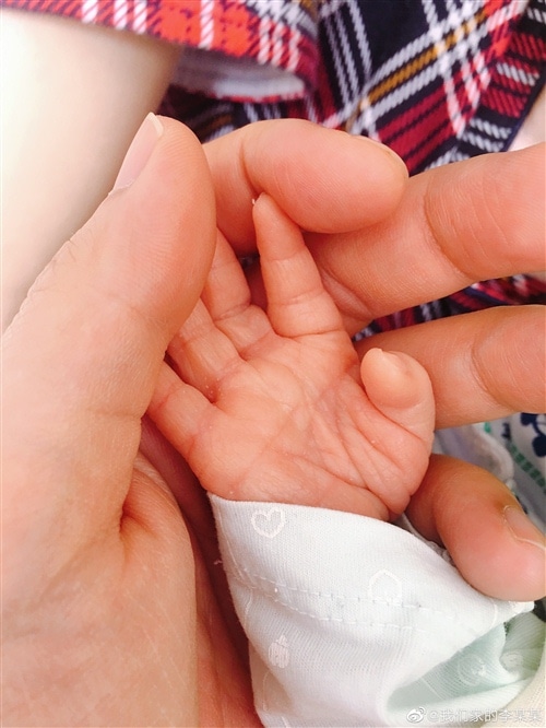 关于剖腹产的心情说说